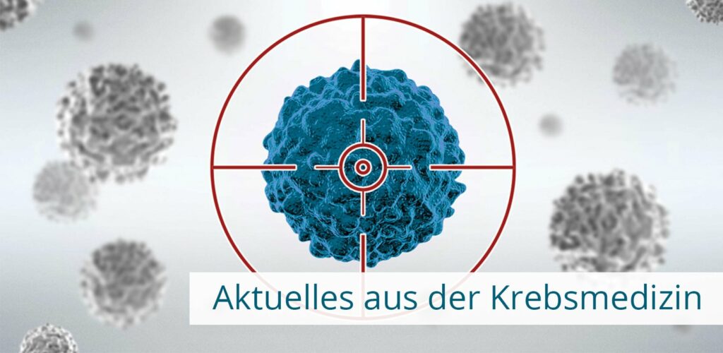 experimentelle-immuntherapie-gegen-metastasierenden-brustkrebs